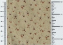 qbd 4514-200